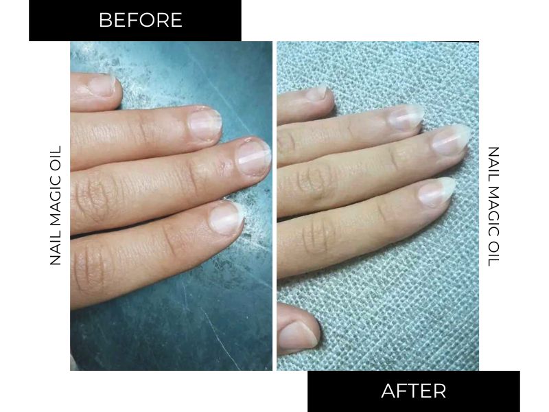 Double nail oil offer