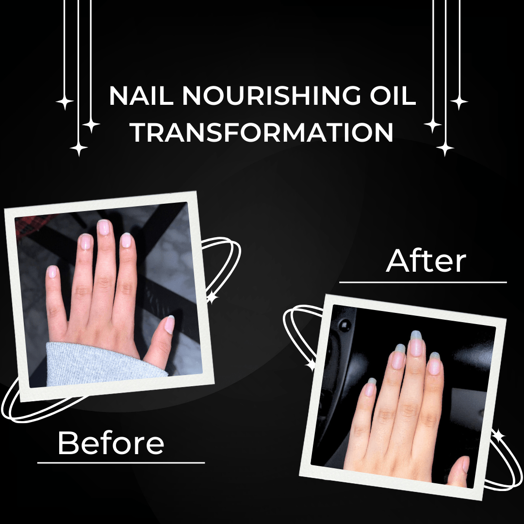 Nail Magic Nourishing oil