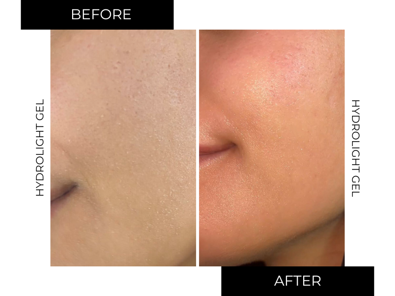 Hydrolight Moisturizer + FREE Travel Size Cleanser