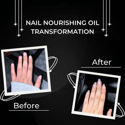 Nail Nourishing oil